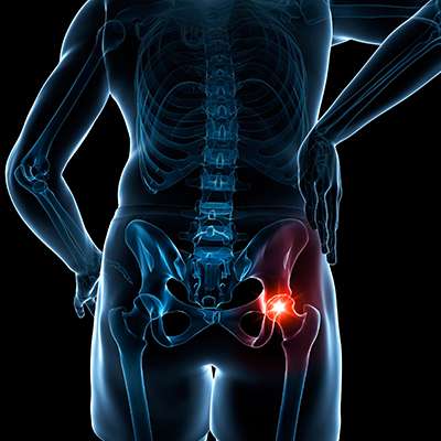 hip pain